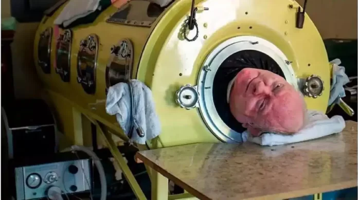 Murio-hombre-pulmon-hierro